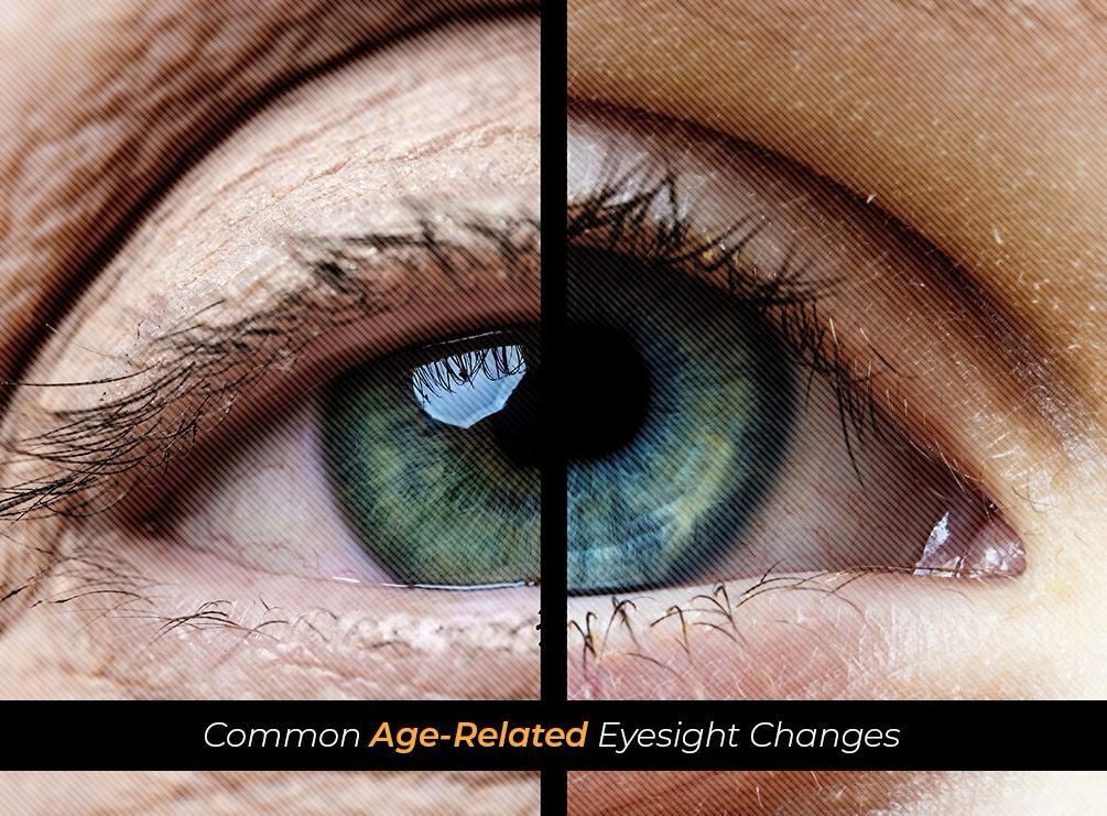 Common Age-Related Eyesight Changes