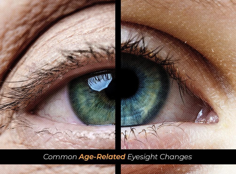 Common AgeRelated Eyesight Changes