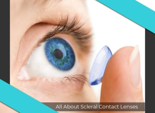 all about contact lenses